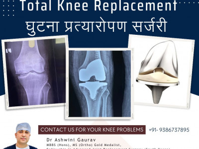 Dr. Ashwini Gaurav | Ortho Patna | Best Orthopedic Doctor in Patna | Arthritis Doctor & Best Joint  photo 1