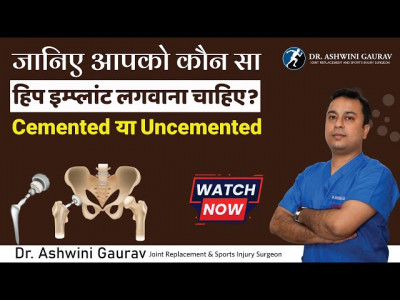 Dr. Ashwini Gaurav | Ortho Patna | Best Orthopedic Doctor in Patna | Arthritis Doctor & Best Joint  photo 4