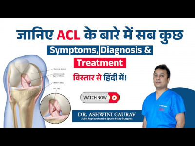 Dr. Ashwini Gaurav | Ortho Patna | Best Orthopedic Doctor in Patna | Arthritis Doctor & Best Joint  photo 6