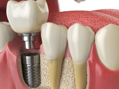 Holistic Dental Melbourne CBD photo 3