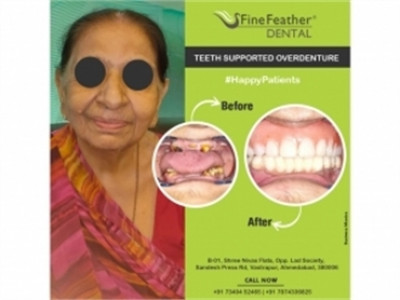 Vanamo Care Pvt. Ltd. | Fine Feather Dental  photo 1