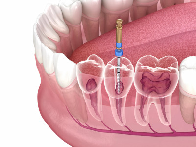 Hills Dental Boutique photo 3