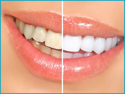 Neo Smile Dental Clinic photo 2