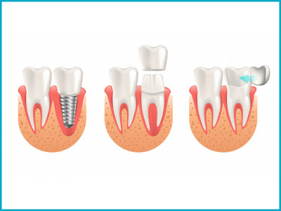 Neo Smile Dental Clinic photo 3
