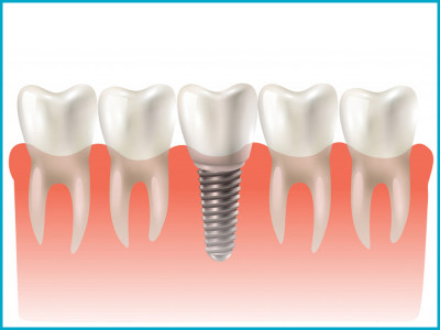 Neo Smile Dental Clinic photo 4