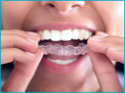 Neo Smile Dental Clinic photo 5