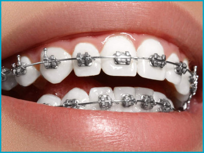 Neo Smile Dental Clinic photo 6