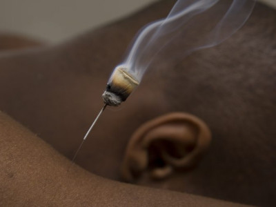 Acubody Therapies  photo 2