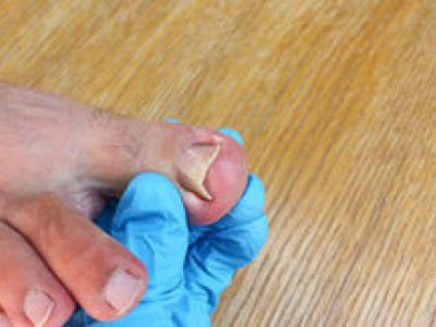 Harley Medical Foot and Nail Laser Clinic photo 1