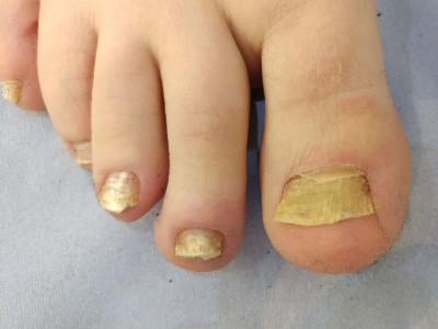Harley Medical Foot and Nail Laser Clinic photo 2
