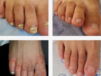 Harley Medical Foot and Nail Laser Clinic photo 3